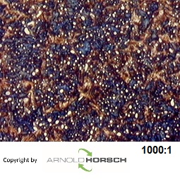 Datei:100Cr6-1.jpg