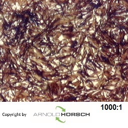 Datei:100Cr6-2.jpg
